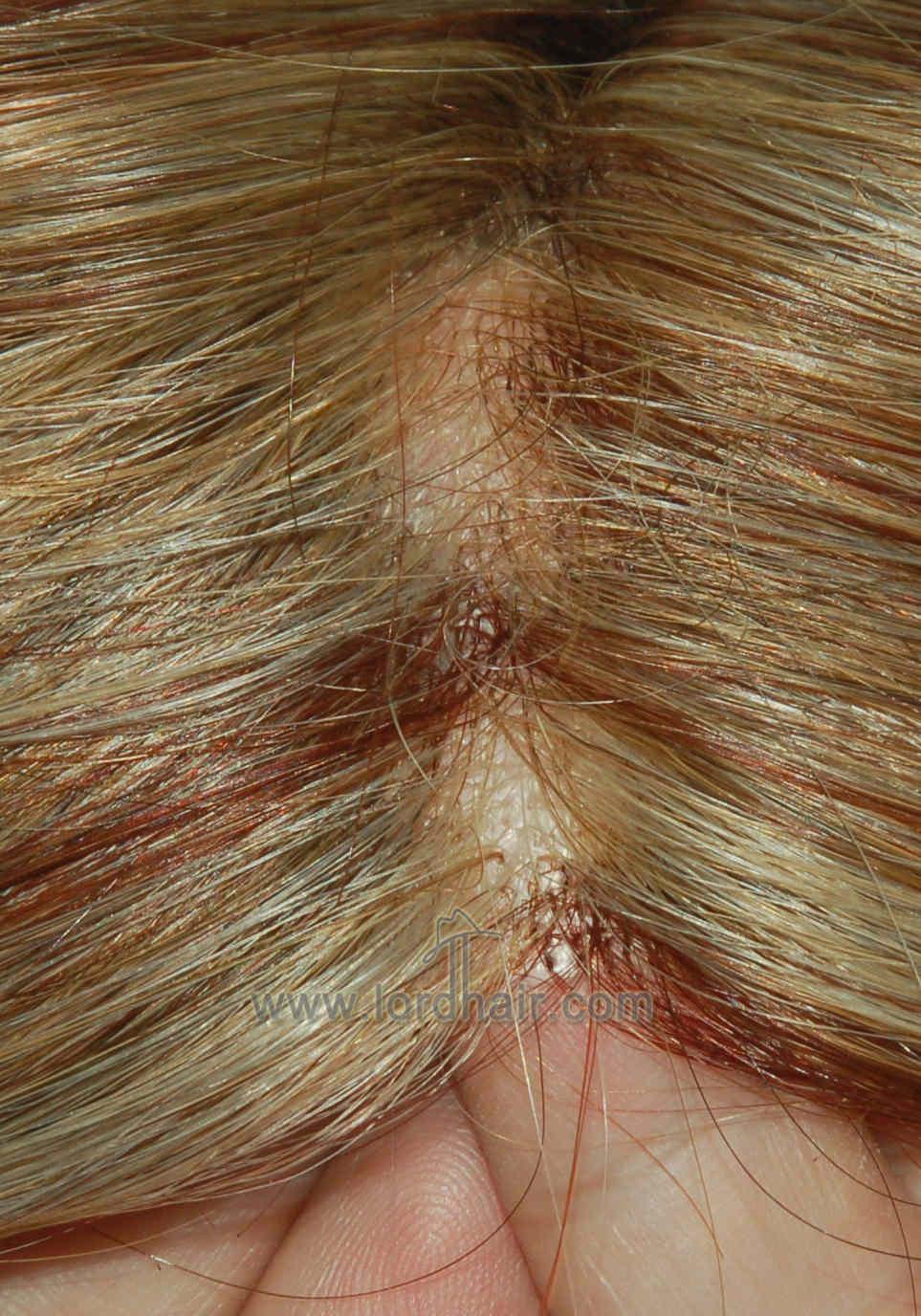 f689 hair toupee