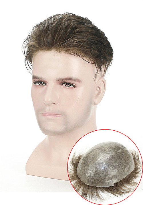 s22 hair replacement system