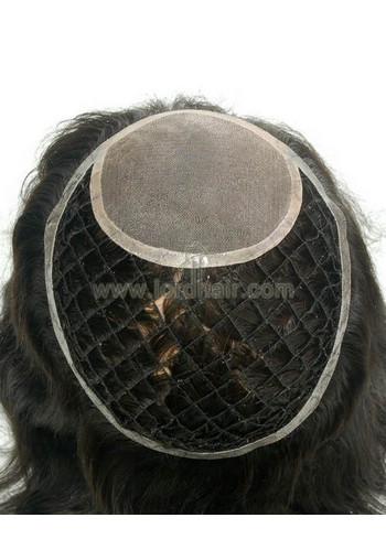 yj176 hair replacement system