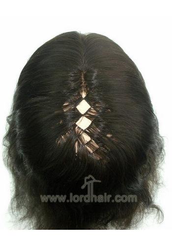 yj176 hair replacement system