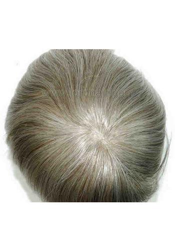 jq1098 hair replacement system