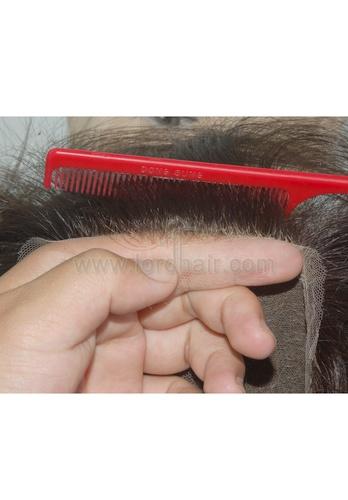 l3 hair replacement system