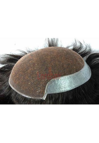 l3 hair replacement system