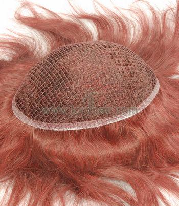 s10 integration hair replacement system