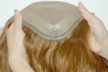 s5 hair replacement system