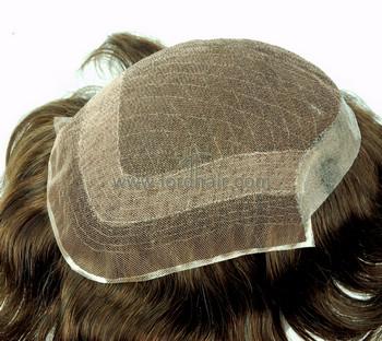 s8 hair replacement system