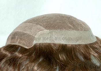 s8 hair replacement system