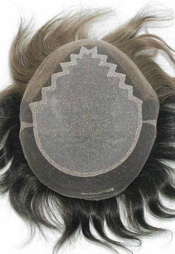 jq1307 hair replacement system