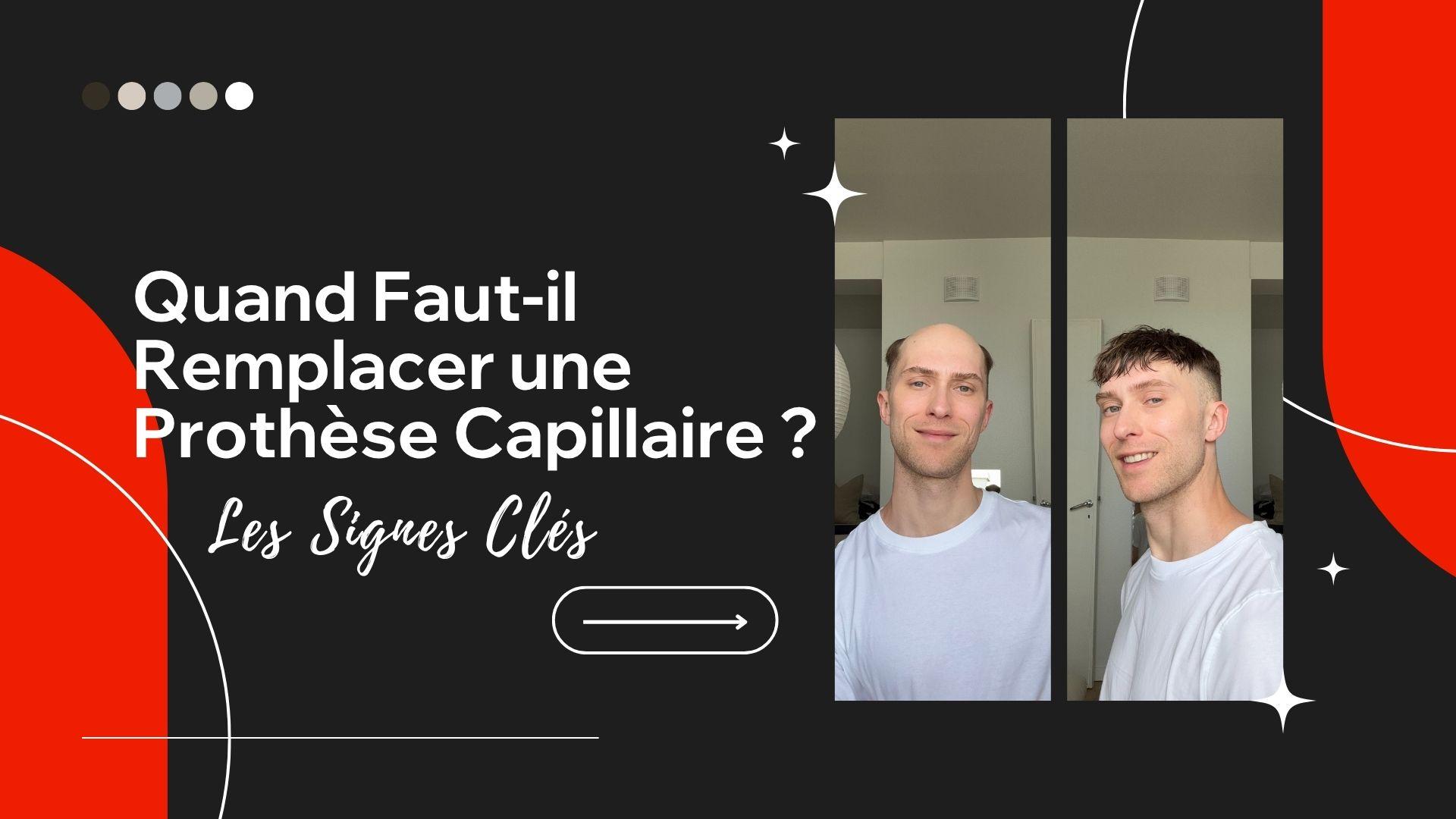 Durée de vie d’une prothèse capillaire : Comment savoir quand il est temps de la remplacer