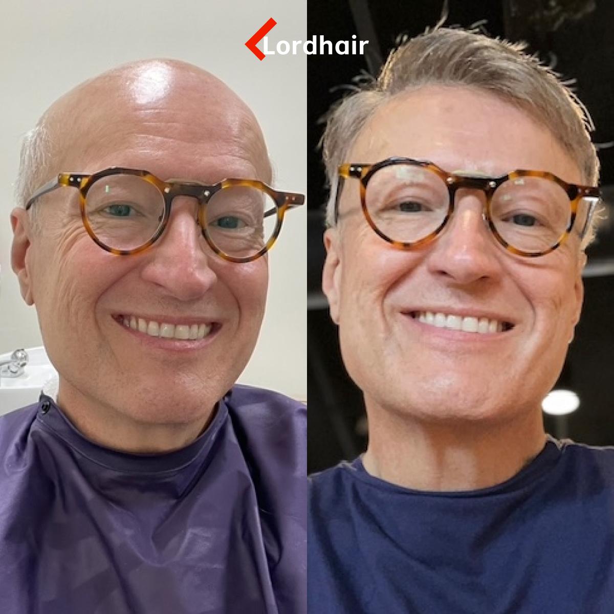 Prothèse Capillaire Poivre et Sel : Le Guide Complet pour un Look Naturel et Indétectable