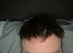 Client portant une prothèse capillaire grise Lordhair