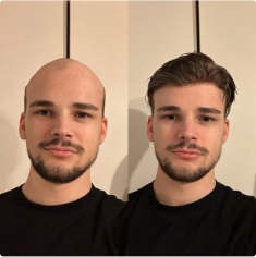 Before and after transformation