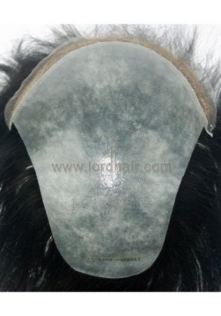 FRF017