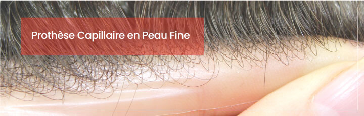 Compléments Capillaires en Peau Fine Compléments Capillaires en Peau Fine