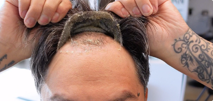 Guide Expert : Comment appliquer prothèse capillaire avec colle plus...