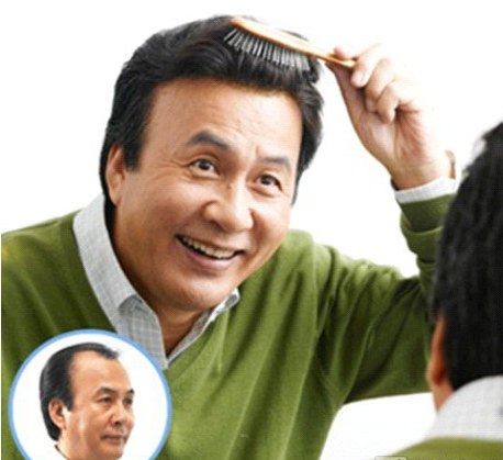 Men's toupee, hair systems