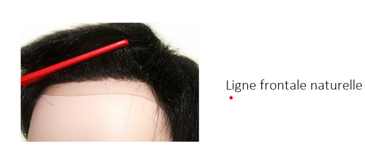 S1-INS ligne frontale