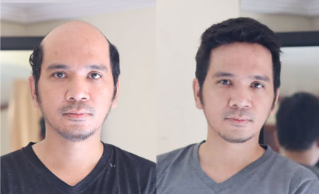 0.03 MM Ultra Thin Skin Hair Systems